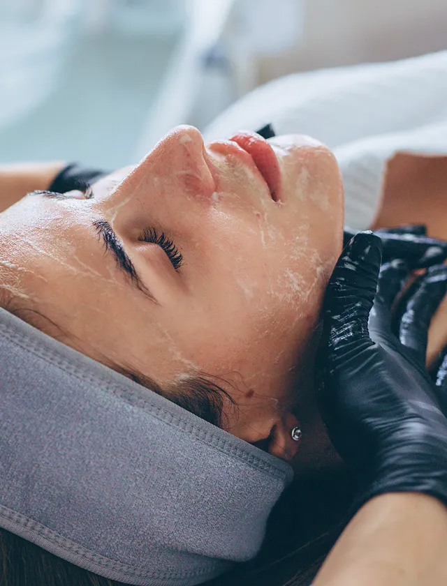 Kemisk peeling Kemisk peeling mot pormaskar och finnar