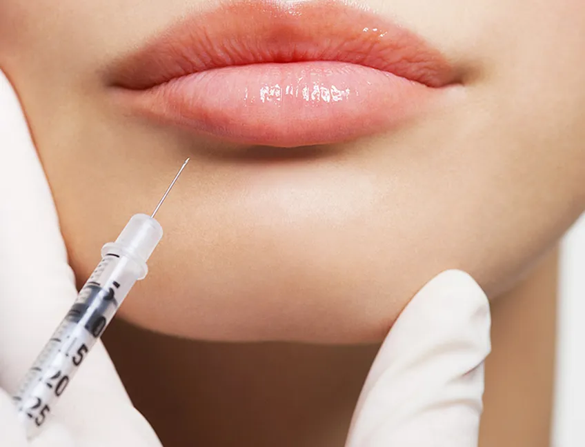 Fillers Fillers