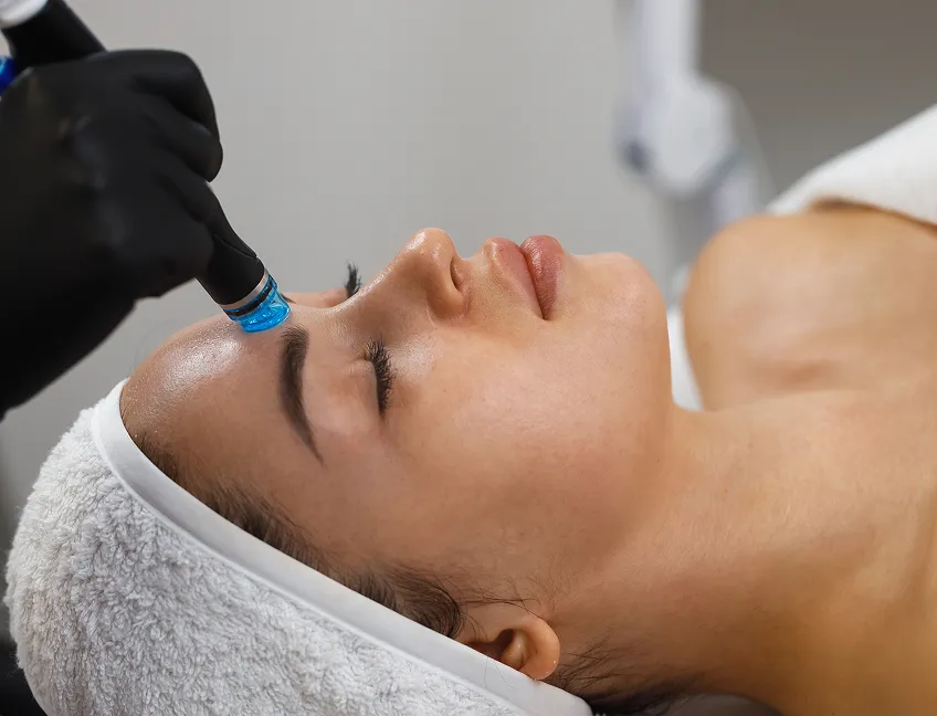 Microneedling Microneedling