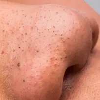 Pormaskar